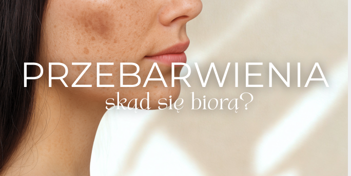 Skąd biorą się przebarwienia na skórze?